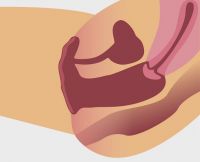 Vergroesserte Vagina